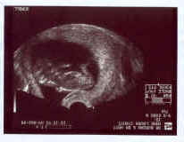 Sidney's Ultrasound 1