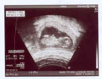 Sidney's Ultrasound 2